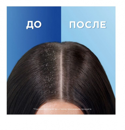 Шампунь против перхоти Head&Shoulders Основной уход 400мл